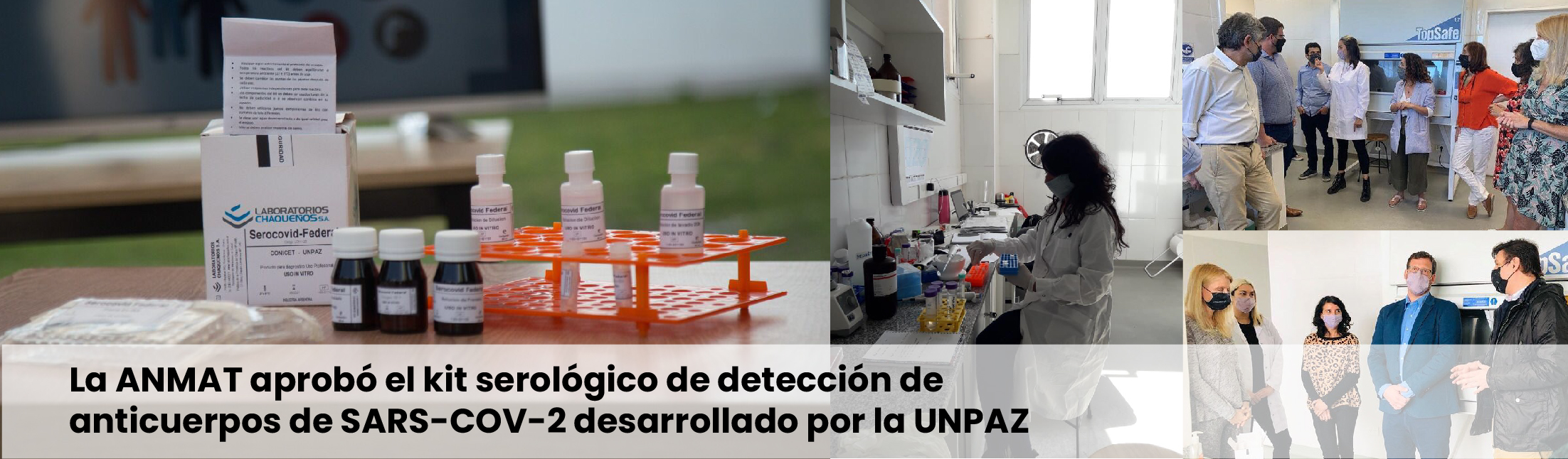 La ANMAT aprobó el kit serológico de detección de anticuerpos de SARS-COV-2 desarrollado por la UNPAZ